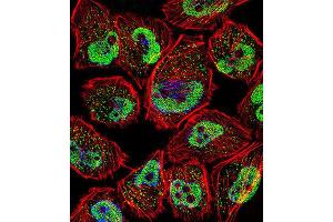Immunofluorescence (IF) image for anti-Kruppel-Like Factor 5 (Intestinal) (KLF5) antibody (ABIN3003155) (KLF5 antibody)