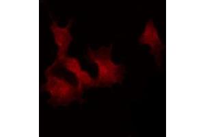 ABIN6269360 staining K562 by IF/ICC. (STAT4 antibody  (C-Term))