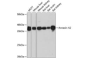 Western blot analysis of extracts of various cell lines, using Annexin  Rabbit mAb (ABIN7265619) at 1:1000 dilution. (Annexin A2 antibody)