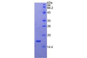 SDS-PAGE analysis of Rat VEGFB Protein. (VEGFB Protein)