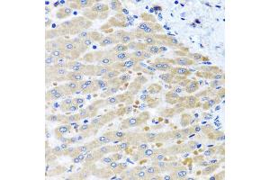 Immunohistochemistry of paraffin-embedded human liver injury using DARS2 antibody.