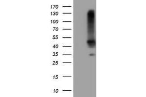 Image no. 2 for anti-serpin Peptidase Inhibitor, Clade B (Ovalbumin), Member 1 (SERPINB1) (AA 77-306) antibody (ABIN1491673) (SERPINB1 antibody  (AA 77-306))