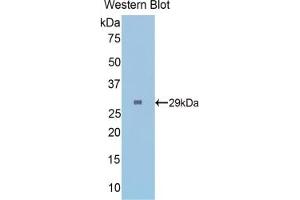 Detection of Recombinant FGg, Mouse using Polyclonal Antibody to Fibrinogen Gamma (FGg) (FGG antibody  (AA 168-405))