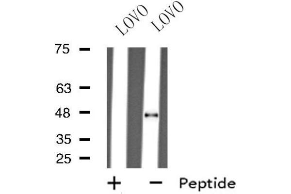 GHRHR antibody  (C-Term)