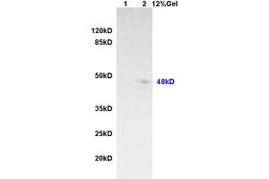 Lane 1: rat brain lysates Lane 2: rat heart lysates probed with Anti phospho-GFAP (Ser8) Polyclonal Antibody, Unconjugated (ABIN800838) at 1:200 in 4 °C. (GFAP antibody  (pSer8))