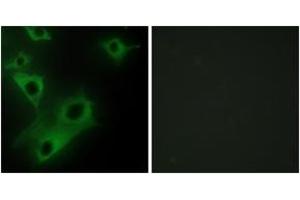 Immunofluorescence analysis of HeLa cells, using CIDEC Antibody. (CIDEC antibody  (AA 189-238))