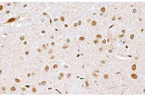Immunohistochemistry of paraffin-embedded Rat brain using CBX6 Polyclonal Antibody at dilution of 1:100 (40x lens).