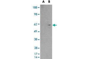 HEK293 overexpressing RXRB and probed with RXRB polyclonal antibody  (mock transfection in first lane), tested by Origene.