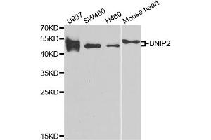 Western blot analysis of extracts of various cell lines, using BNIP2 antibody (ABIN5973707) at 1/1000 dilution. (BNIP2 antibody)