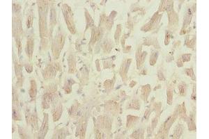 Immunohistochemistry of paraffin-embedded human heart tissue using ABIN7160958 at dilution of 1:100 (NDUFS3 antibody  (AA 37-264))
