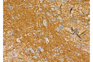 ABIN6266242 and ABIN6277394 at 1/100 staining Rat brain tissue by IHC-P. (Kallikrein 5 antibody  (Internal Region))