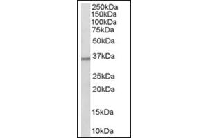 Image no. 1 for anti-Hydroxysteroid (11-Beta) Dehydrogenase 1 (HSD11B1) (C-Term) antibody (ABIN374504)
