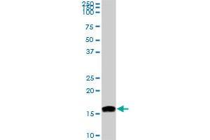 NME2 monoclonal antibody (M06), clone 1D3. (NME2 antibody  (AA 51-152))