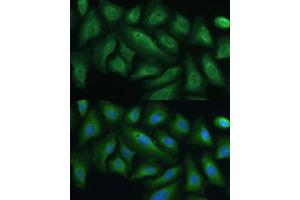 Immunofluorescence analysis of U-2 OS cells using PTPN22 antibody (ABIN3021952, ABIN3021953, ABIN1513449 and ABIN6218285) at dilution of 1:100. (PTPN22 antibody  (AA 1-90))