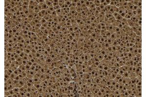 ABIN6278564 at 1/100 staining Rat liver tissue by IHC-P. (TPX2 antibody  (C-Term))
