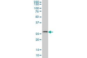 CA7 monoclonal antibody (M06), clone 3B7 Western Blot analysis of CA7 expression in Hela S3 NE . (CA7 antibody  (AA 34-125))