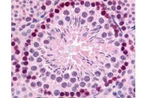 Immunohistochemistry (IHC) image for anti-GLI Family Zinc Finger 2 (GLI2) (Internal Region) antibody (ABIN129624)