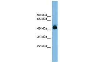 Image no. 1 for anti-G Protein-Coupled Receptor 87 (GPR87) (AA 251-300) antibody (ABIN6744725) (GPR87 antibody  (AA 251-300))