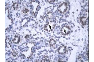 Image no. 1 for anti-YEATS Domain Containing 4 (AA 158-207) antibody (ABIN6735809) (GAS41 antibody  (AA 158-207))