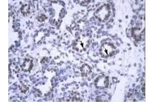 Image no. 1 for anti-YEATS Domain Containing 4 (AA 158-207) antibody (ABIN6735809)