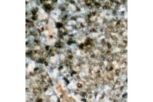 Immunohistochemical analysis of HSL (pS552) staining in human lymph node formalin fixed paraffin embedded tissue section. (LIPE antibody  (pSer552))