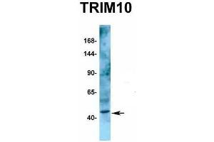 Host:  Rabbit  Target Name:  TRIM10  Sample Type:  Human Fetal Kidney  Antibody Dilution:  1. (TRIM10 antibody  (C-Term))