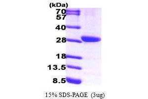 Hydroxyprostaglandin Dehydrogenase 15-(NAD) (HPGD) (AA 1-266) protein (His tag)