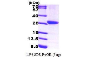 SDS-PAGE (SDS) image for Hydroxyprostaglandin Dehydrogenase 15-(NAD) (HPGD) (AA 1-266) protein (His tag) (ABIN7279169) (HPGD Protein (AA 1-266) (His tag))