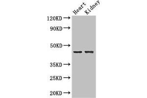 Western Blot Positive WB detected in: Mouse heart tissue, Mouse kidney tissue All lanes: NRXN1 antibody at 2 μg/mL Secondary Goat polyclonal to rabbit IgG at 1/50000 dilution Predicted band size: 47, 51, 162, 165, 170, 16 kDa Observed band size: 47 kDa (Neurexin 1 antibody  (AA 184-363))