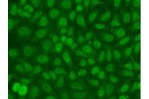 Immunofluorescence analysis of A549 cell using TSEN2 antibody.