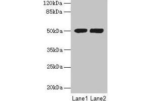 Western blot All lanes: TUBA3E antibody at 3 μg/mL Lane 1: MCF-7 whole cell lysate Lane 2: Hela whole cell lysate Secondary Goat polyclonal to rabbit IgG at 1/10000 dilution Predicted band size: 50 kDa Observed band size: 50 kDa (TUBA3E antibody  (AA 1-250))