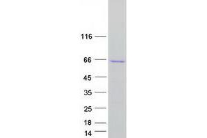 Validation with Western Blot (NUP50 Protein (Transcript Variant 2) (Myc-DYKDDDDK Tag))