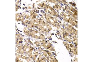 Immunohistochemistry of paraffin-embedded human gastric injury using ASMTL antibody at dilution of 1:100 (x400 lens).