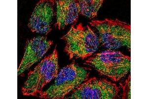 Fluorescent confocal image of HeLa cell stained with LSD1 antibody.