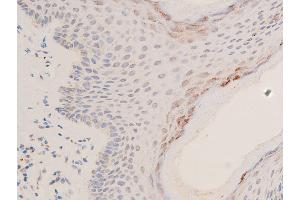 ABIN6267066 at 1/200 staining human skin tissue sections by IHC-P. (p53 antibody  (acLys319))