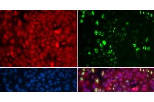 Immunofluorescence analysis of U2OS cells using Phospho-ABL1(Y204) Polyclonal Antibody (ABL1 antibody  (pTyr204))