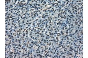 Immunohistochemical staining of paraffin-embedded pancreas tissue using anti-FERMT2mouse monoclonal antibody. (FERMT2 antibody)