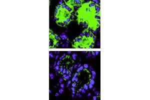 Immunohistochemical staining. (IL-18 antibody)