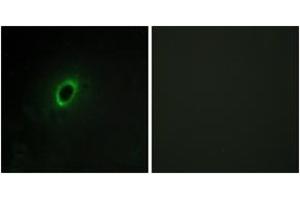 Immunofluorescence analysis of HeLa cells, using BEGIN Antibody. (BEGAIN antibody  (AA 511-560))