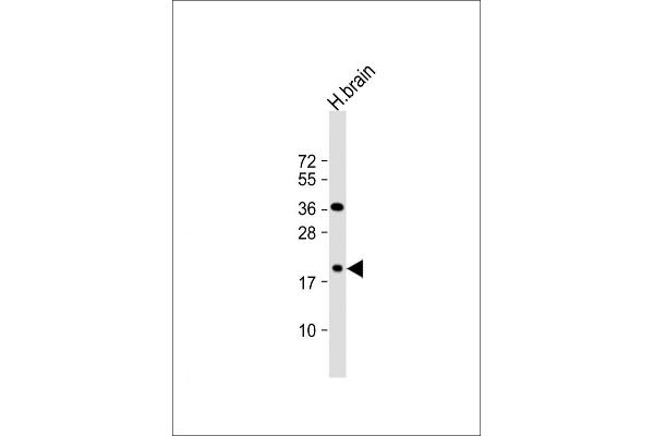 beta Synuclein antibody  (C-Term)