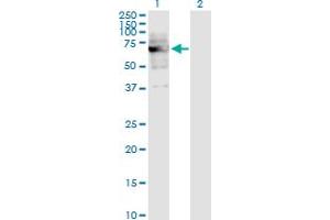Western Blot analysis of DKC1 expression in transfected 293T cell line by DKC1 monoclonal antibody (M04), clone 3E10. (DKC1 antibody  (AA 1-514))