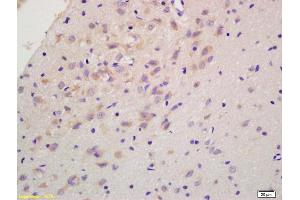 Formalin-fixed and paraffin embedded rat brain labeled with Anti-RGS2 Polyclonal Antibody, Unconjugated (ABIN669291) at 1:200 followed by conjugation to the secondary antibody and DAB staining. (RGS2 antibody  (AA 116-211))