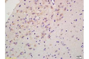 Formalin-fixed and paraffin embedded rat brain labeled with Anti-RGS2 Polyclonal Antibody, Unconjugated (ABIN669291) at 1:200 followed by conjugation to the secondary antibody and DAB staining.