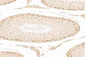 Immunohistochemistry analysis of paraffin-embedded mouse testis using,ZCCHC7 (ABIN7076279) at dilution of 1: 3000