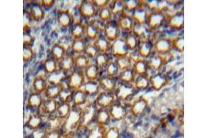 Used in DAB staining on fromalin fixed paraffin-embedded kidney tissue (NOG antibody  (AA 28-232))