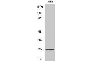 Western Blotting (WB) image for anti-Gap Junction Protein, beta 2, 26kDa (GJB2) (Internal Region) antibody (ABIN3184038) (GJB2 antibody  (Internal Region))