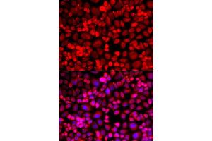 Immunofluorescence analysis of HeLa cell using ANLN antibody. (Anillin antibody)