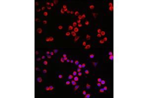 Immunofluorescence analysis of Neuro-2a cells using G Rabbit pAb (ABIN6127469, ABIN6140954, ABIN6140955 and ABIN6221997) at dilution of 1:25 (40x lens). (GAP43 antibody  (AA 1-238))