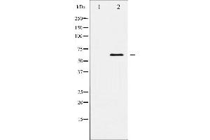 Western blot analysis of Elk1 expression in HeLa whole cell lysates,The lane on the left is treated with the antigen-specific peptide. (ELK1 antibody  (C-Term))