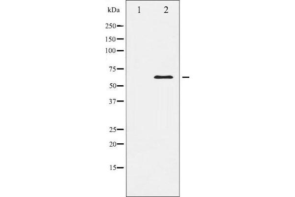 ELK1 anticorps  (C-Term)